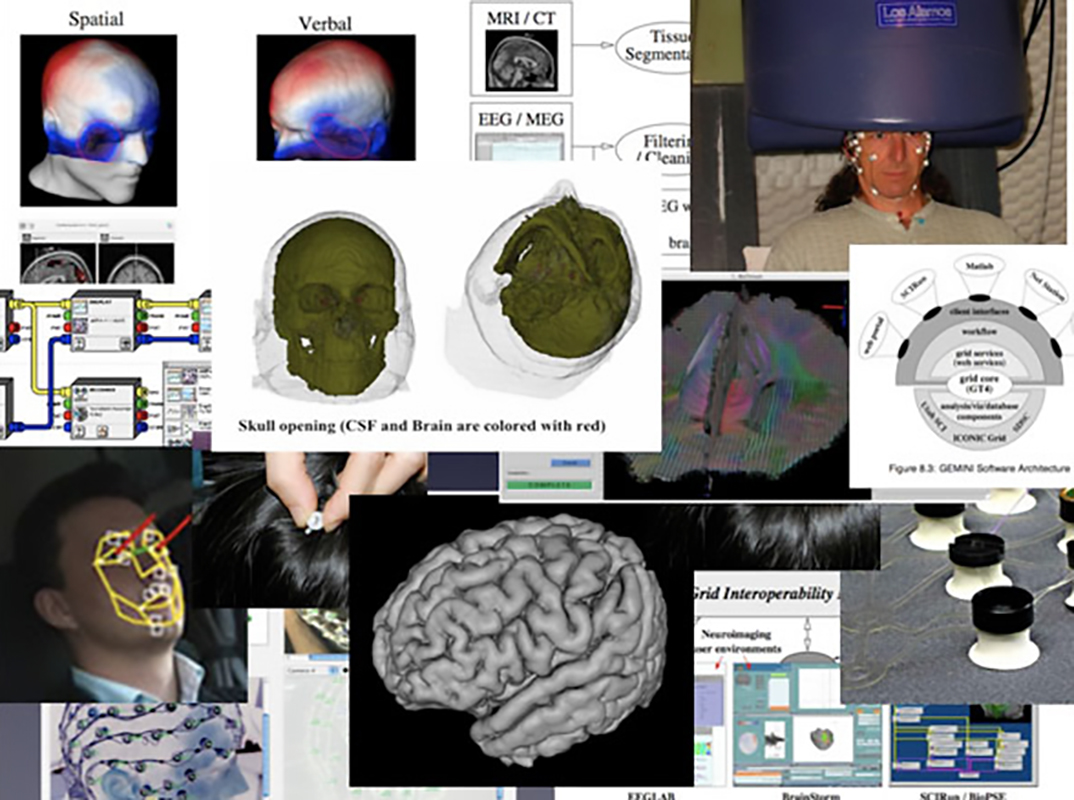 Collage of brain images.